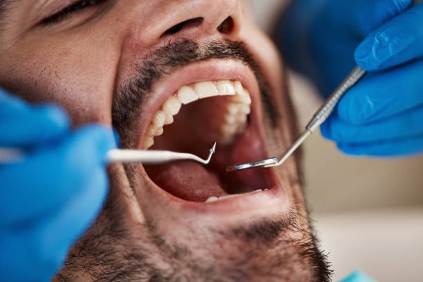 Emergency Dental Services in Brodheadsville, PA